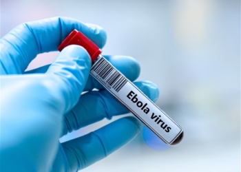 Ebola en RDC : Bangui renforce la vigilance et rassure la population